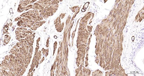 结蛋白抗体-bs-1026R