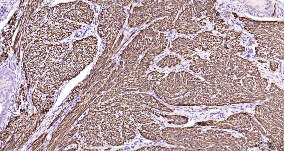 结蛋白抗体-bs-1026R