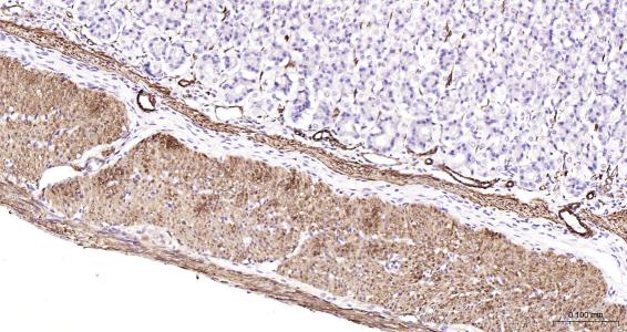 结蛋白抗体-bs-1026R