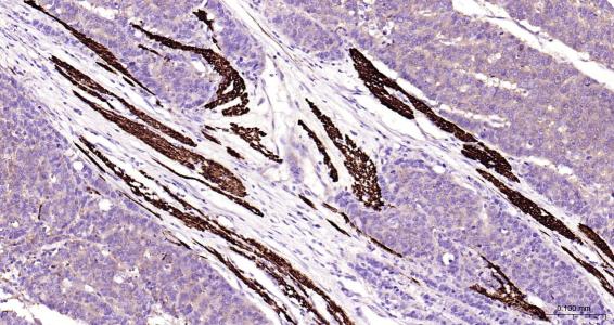 结蛋白抗体-bs-1026R