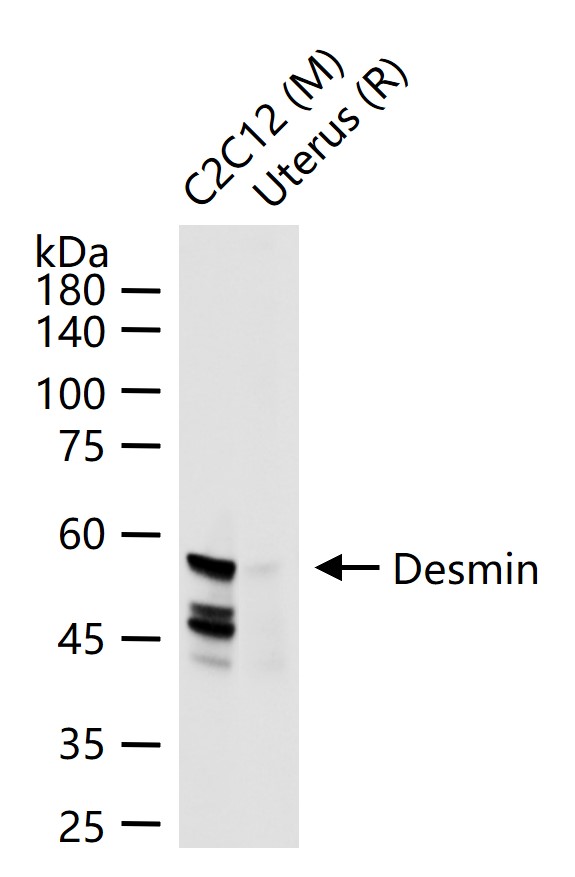 Desmin Rabbit pAb (一抗) - WB,IHC-P,IHC-F,IF,ICC/IF | Bioss