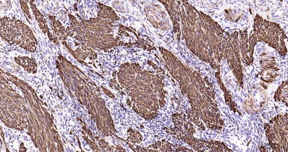 结蛋白抗体-bs-1026R