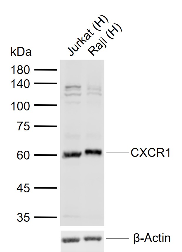 CXCR1 Rabbit pAb (一抗) | Bioss