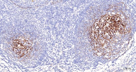 NGFR Mouse mAb (一抗) | Bioss