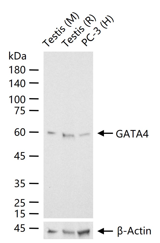 GATA结合蛋白4重组兔单抗