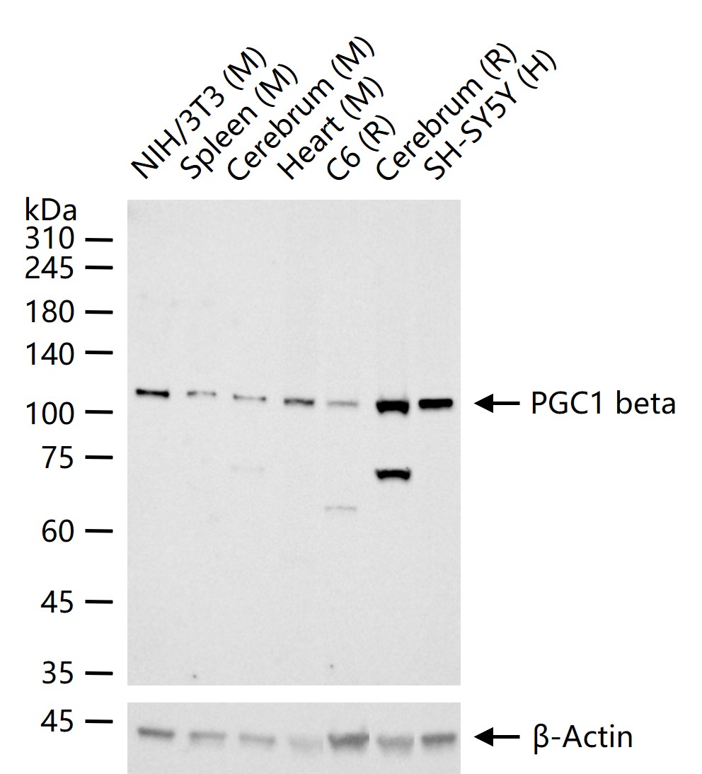 过氧化物酶体增殖物激活受体γ辅激活子1β重组兔单抗
