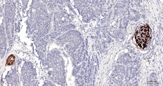 神经生长因子受体单克隆抗体-bsm-43637M