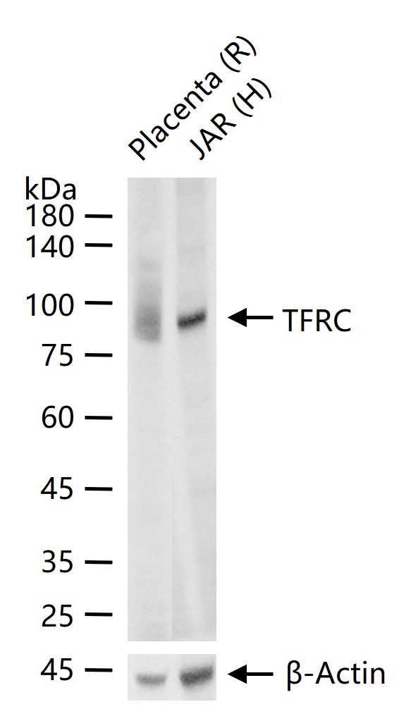转铁蛋白受体(CD71)重组兔单抗