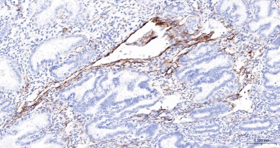 神经生长因子受体单克隆抗体-bsm-43637M
