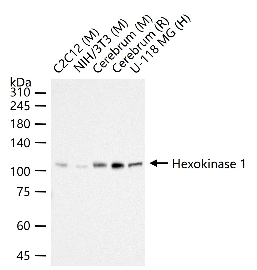 己糖激酶1重组兔单抗
