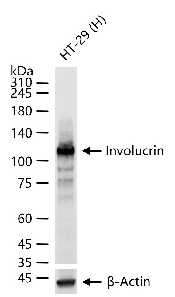 Involucrin Recombinant Rabbit mAb (一抗) - WB,IHC-P,IHC-F,IF,Flow-Cyt | Bioss