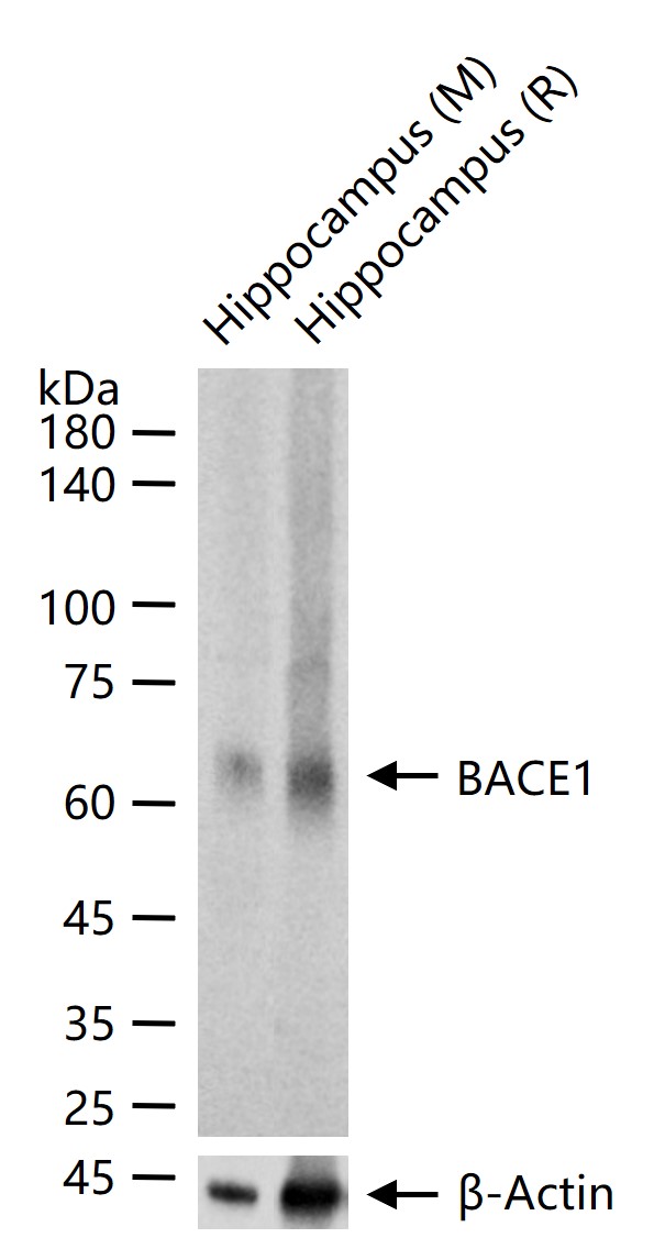 β分泌酶重组兔单抗