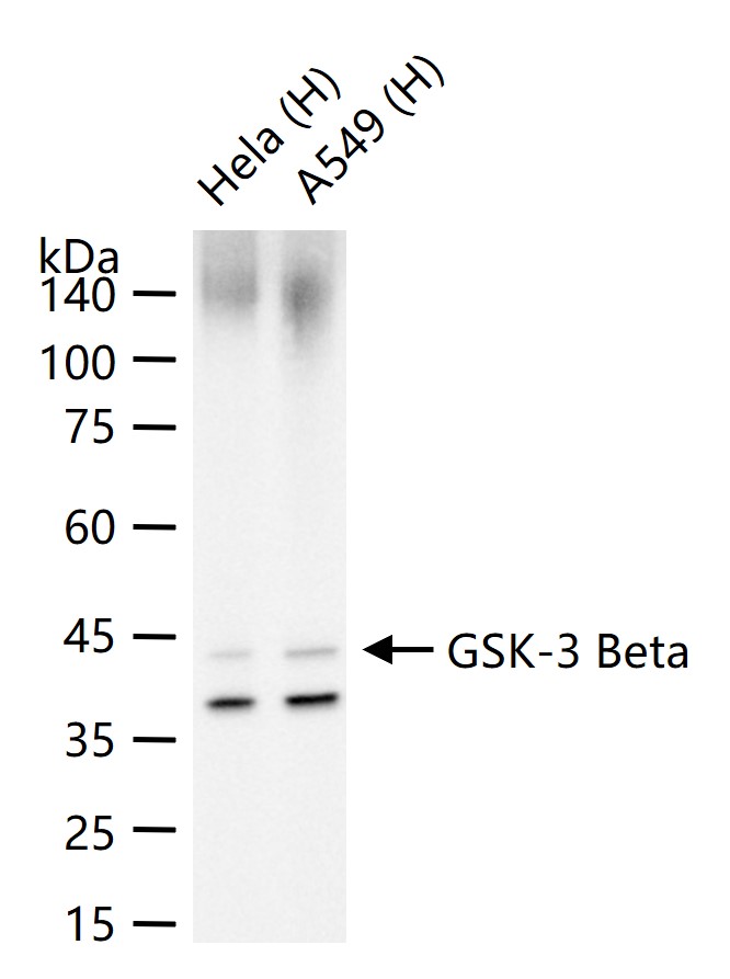 糖原合酶激酶-3β重组兔单抗