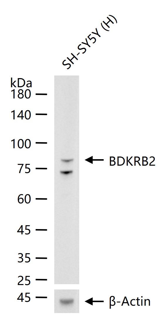 缓激肽B2受体重组兔单抗