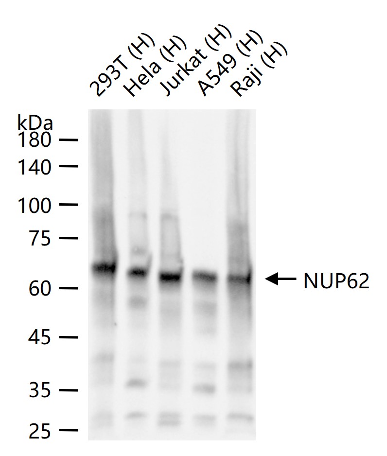 核孔糖蛋白P62重组兔单抗