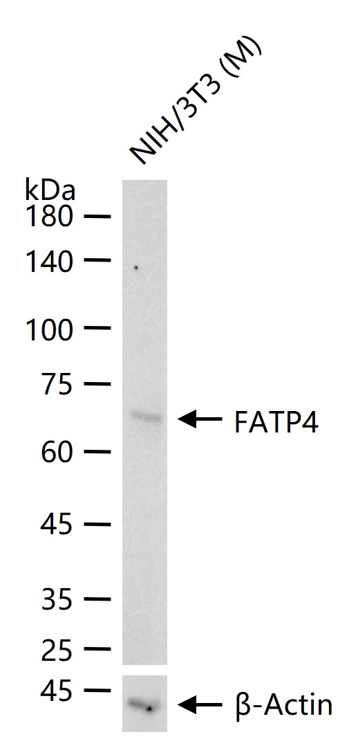 长链脂肪酸转运蛋白4重组兔单抗