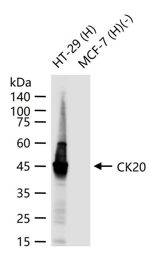 细胞角蛋白20重组兔单抗