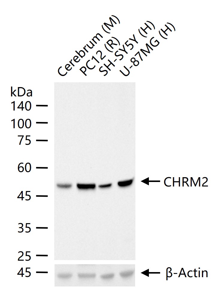 毒蕈碱型乙酰胆碱受体重组兔单抗