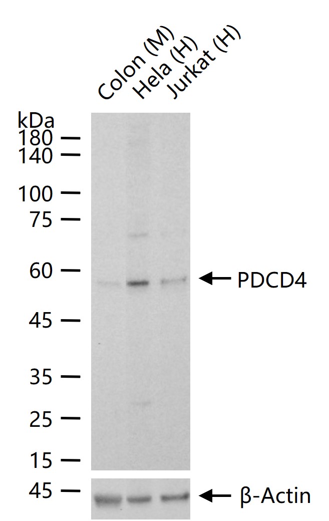 凋亡相关蛋白4重组兔单抗