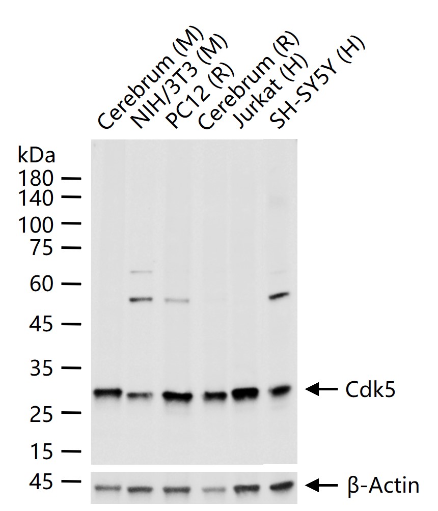 周期素依赖性激酶5重组兔单抗