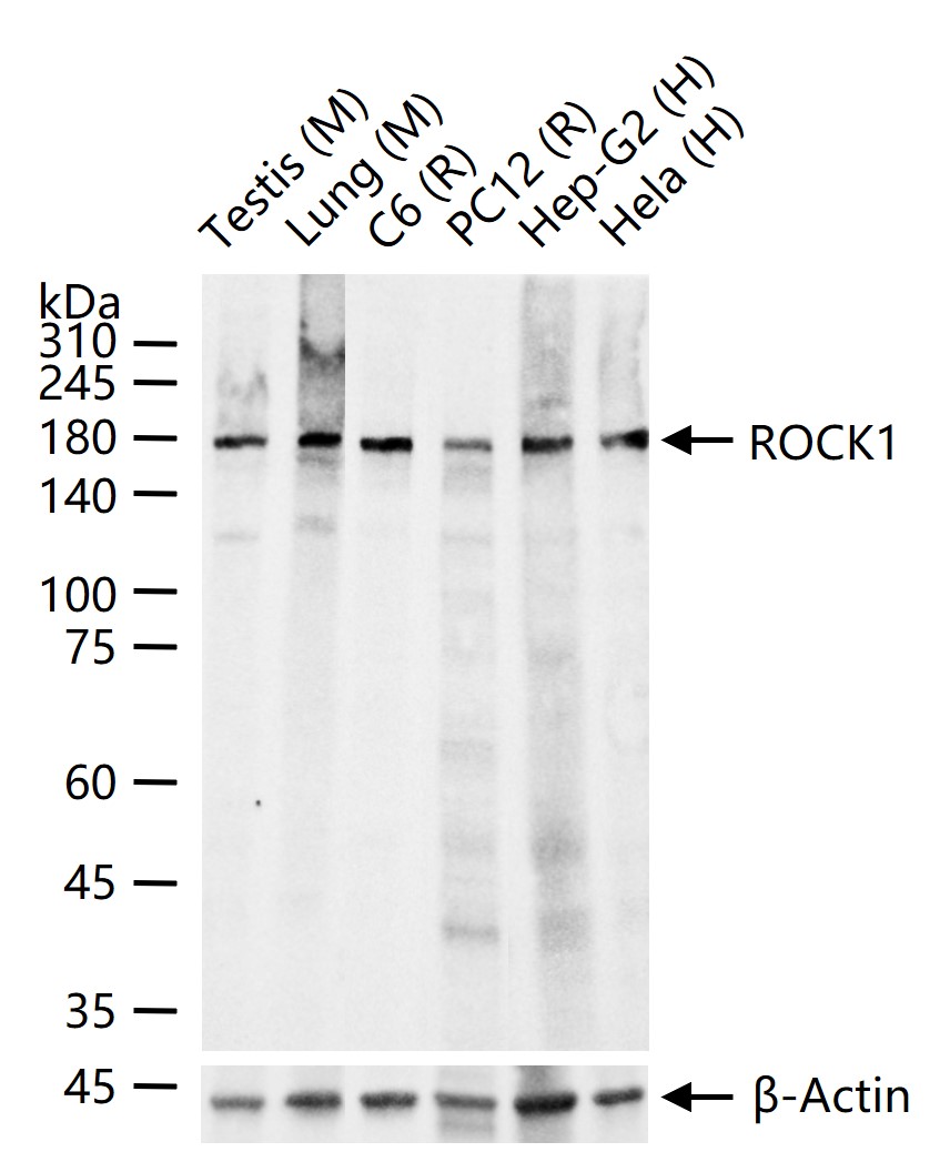 Rho相关蛋白激酶1重组兔单抗
