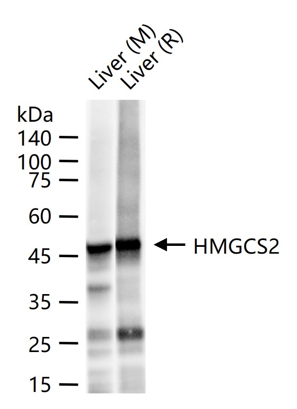 三羟基三甲基辅酶A合成酶2重组兔单抗