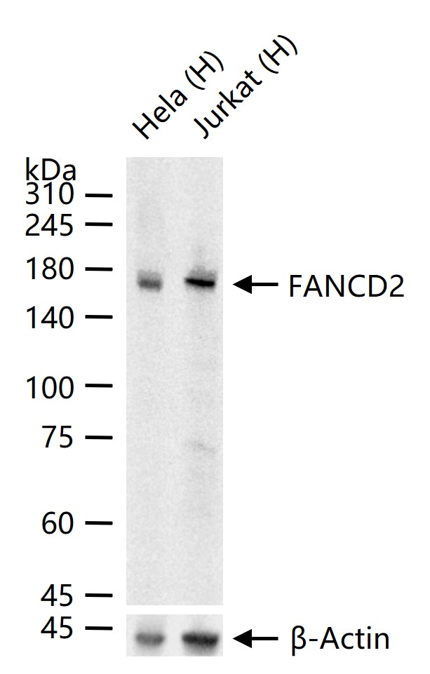 FANCD2 Recombinant Rabbit mAb (一抗) | Bioss