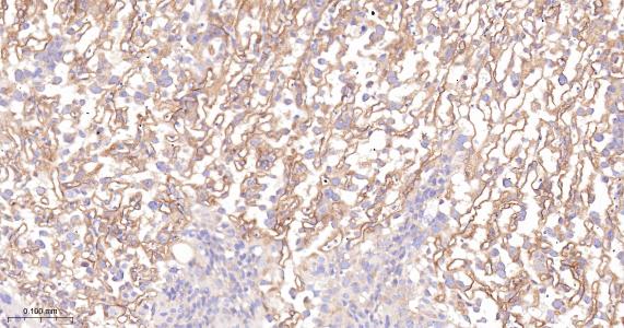 谷氨酰胺转胺酶2重组兔单抗