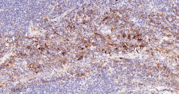 谷氨酰胺转胺酶2重组兔单抗