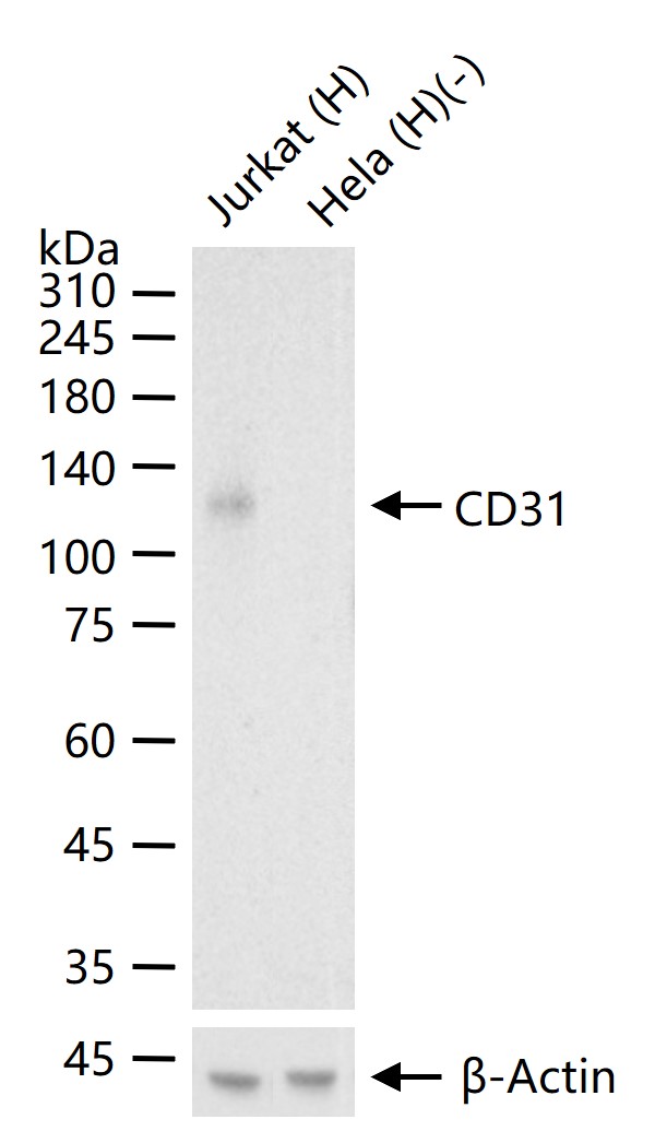血小板内皮细胞黏附分子-1重组兔单抗