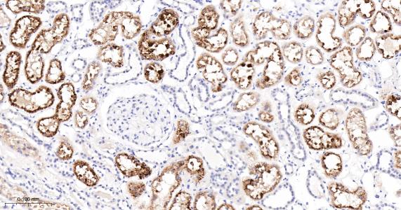 磷酸肌肽3激酶调控亚基4重组兔单抗