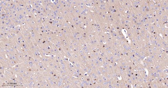 磷酸化微管相关蛋白重组兔单抗