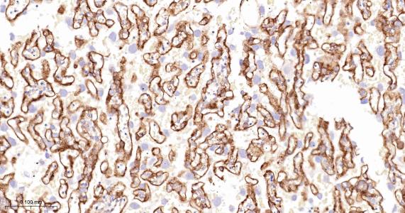 谷氨酰胺转胺酶2重组兔单抗