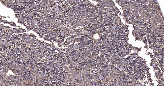 精氨酸酶1重组兔单抗