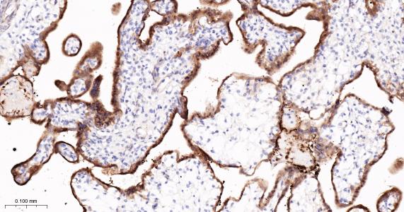 谷氨酰胺转胺酶2重组兔单抗