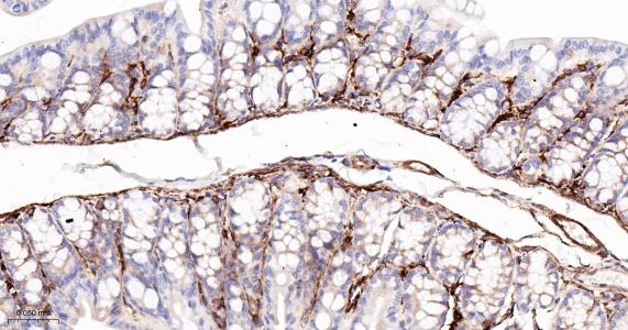 谷氨酰胺转胺酶2重组兔单抗