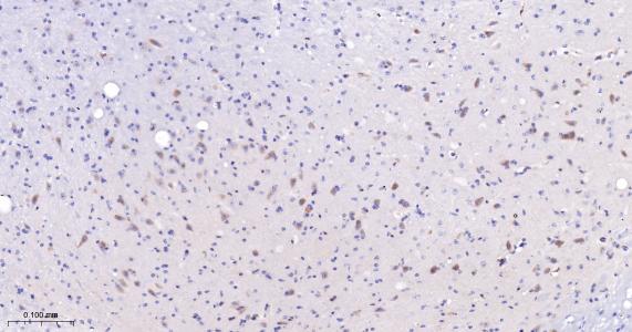 谷氨酰胺转胺酶2重组兔单抗