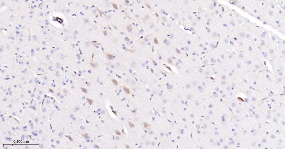 谷氨酰胺转胺酶2重组兔单抗