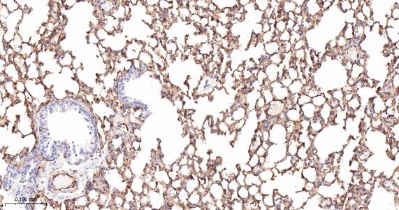 谷氨酰胺转胺酶2重组兔单抗