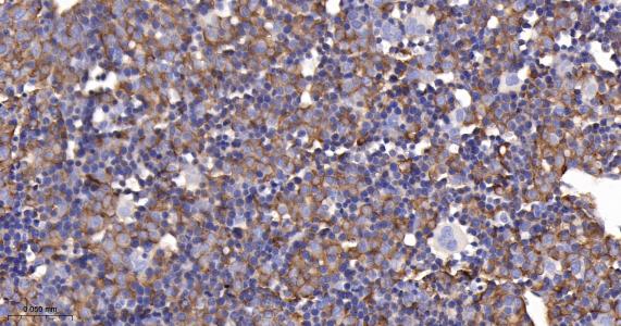 精氨酸酶1重组兔单抗