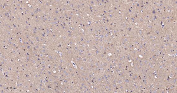 磷酸化微管相关蛋白重组兔单抗