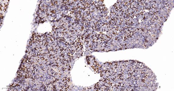 磷酸肌肽3激酶调控亚基4重组兔单抗