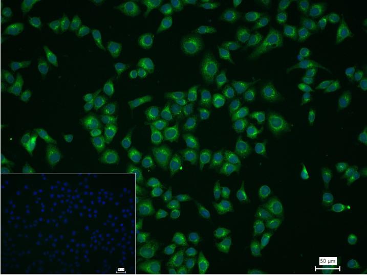 骨形态发生蛋白4重组兔单抗