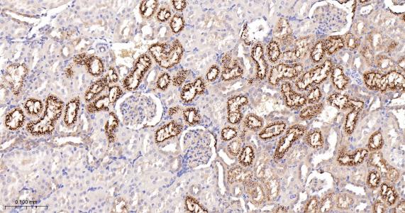 磷酸肌肽3激酶调控亚基4重组兔单抗