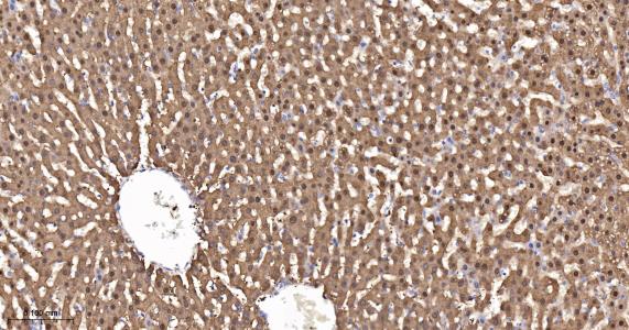 精氨酸酶1重组兔单抗