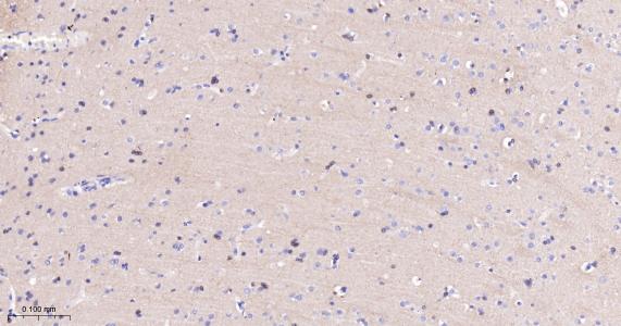 磷酸化微管相关蛋白重组兔单抗