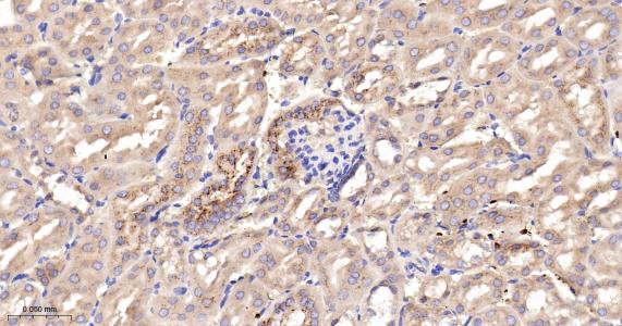 磷酸肌肽3激酶调控亚基4重组兔单抗