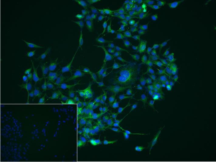 脂肪酸去饱和酶1重组兔单抗