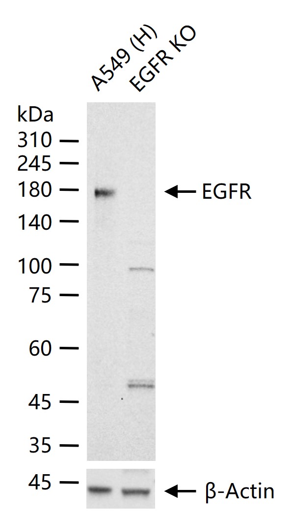 EGFR Mouse mAb (一抗) - WB,IHC-P,IHC-F,IF | Bioss