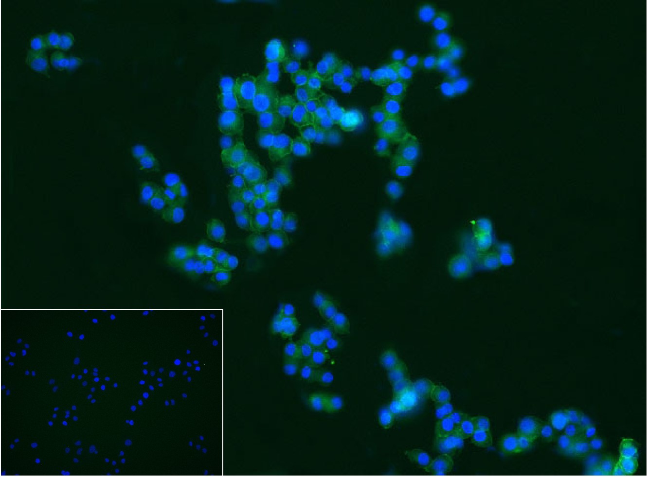 神经生长因子受体重组兔单抗-bsm-52253R